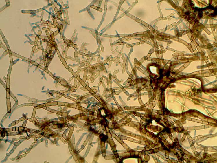 Hallitusseened mikroskoobis Cladosporium-sp. Cladosporium sp.